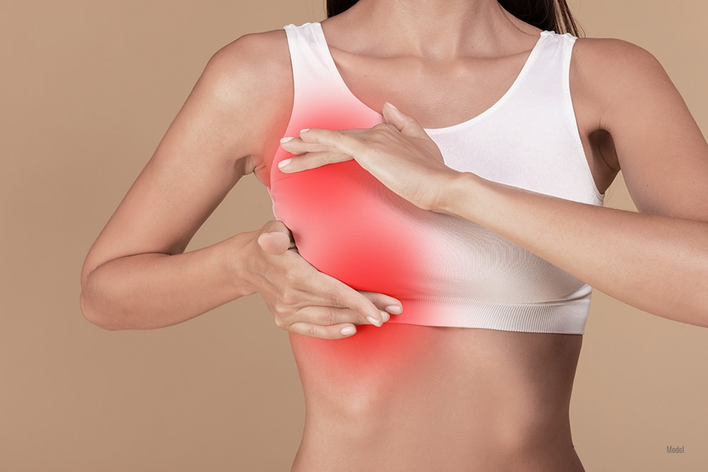 A woman in a white sports bra has her hands placed above and below her right breast, which has red over the area to indicate pain.