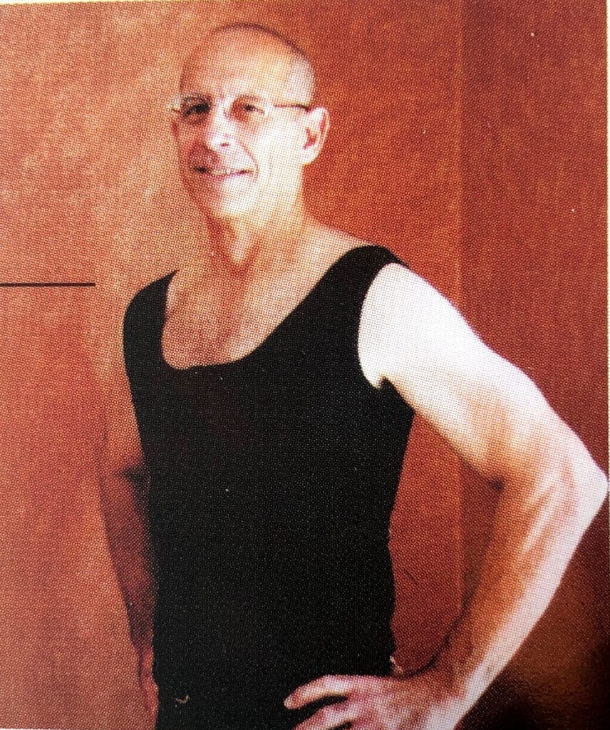 Man wearing a compression garment after gynecomastia surgery.